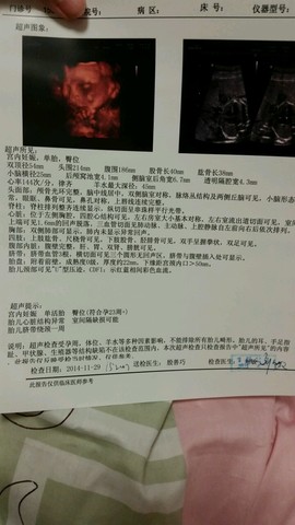 journal_insert_pic_170898358