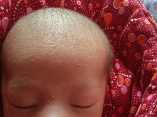 一目了然!宝宝额头高"怀孕的周"-第1张图片-维陆网