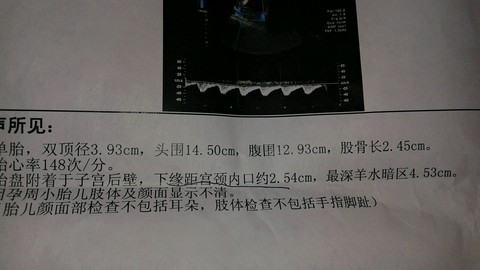 journal_insert_pic_175038644