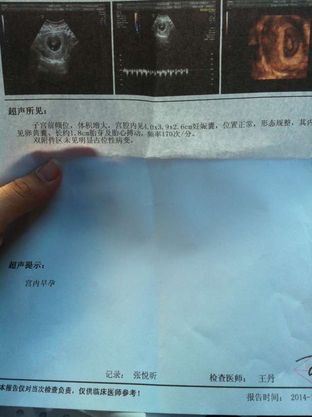 journal_insert_pic_176310558