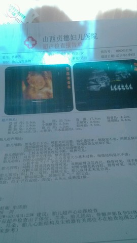 journal_insert_pic_178354718