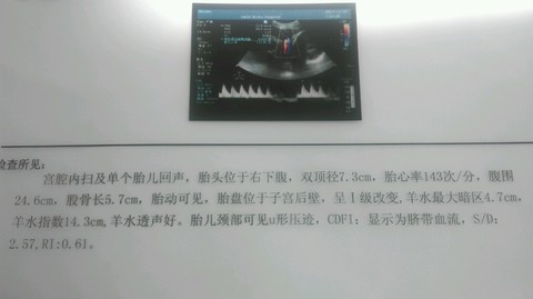 journal_insert_pic_179652694