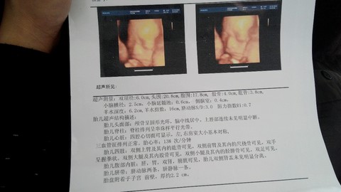 journal_insert_pic_180471393
