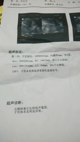 journal_insert_pic_180631574