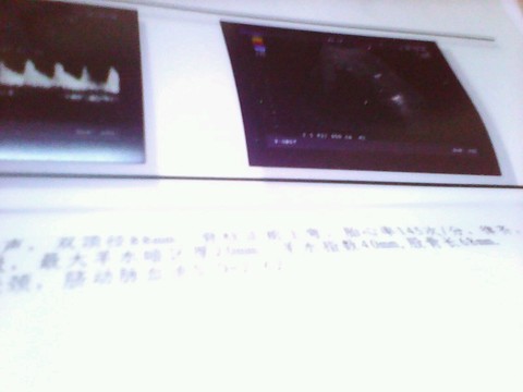 journal_insert_pic_180681121