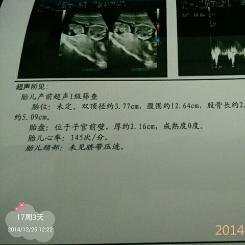 journal_insert_pic_180962015