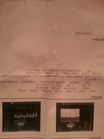 journal_insert_pic_185625796