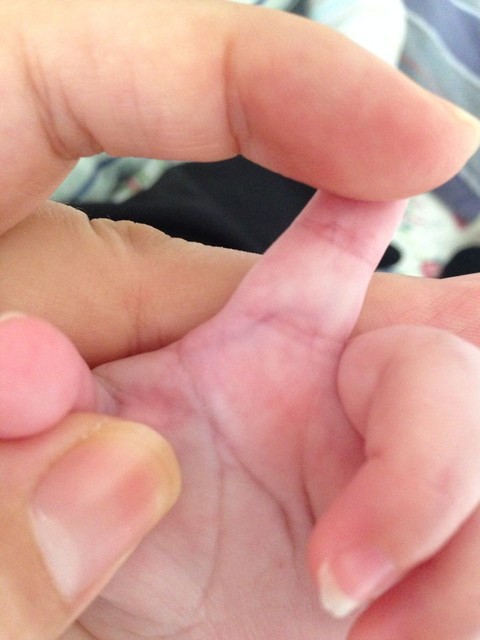 左手食指根部有青筋图图片