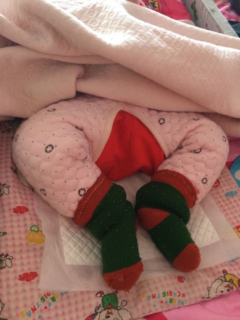 十月的宝宝都可以双腿外展180度了吗,宝妈们都来说说