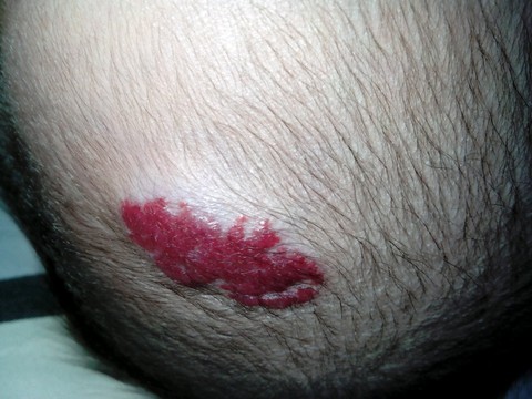 我大儿子头上长的东东可怎麼办?