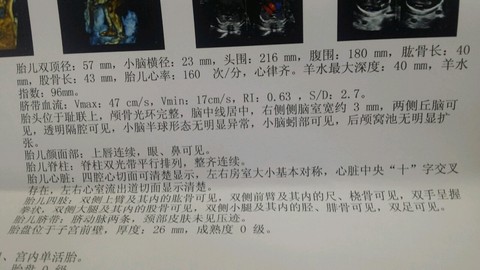 journal_insert_pic_202010315