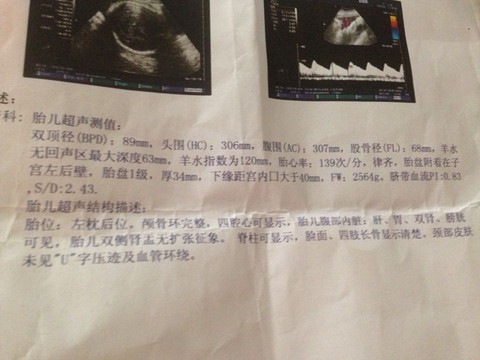 journal_insert_pic_204322583