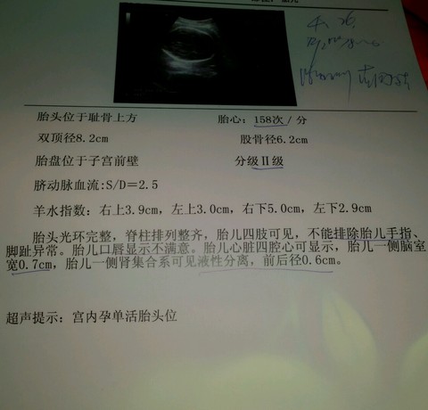 journal_insert_pic_204384090