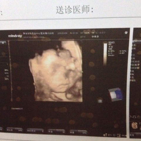 journal_insert_pic_204998670