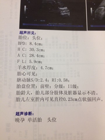 journal_insert_pic_206842964