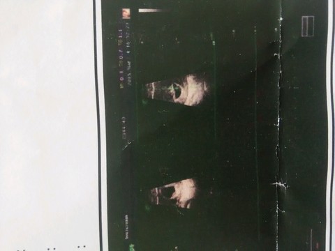 journal_insert_pic_206884134