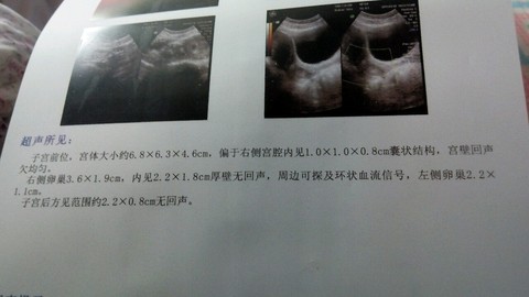 journal_insert_pic_209204517