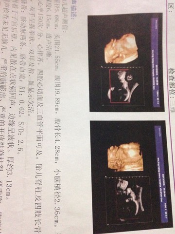 journal_insert_pic_211246577