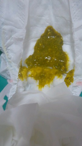 怎么回事?宝妈们,有图慎入!