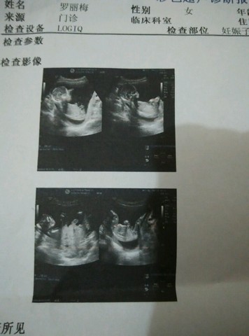 journal_insert_pic_213369522