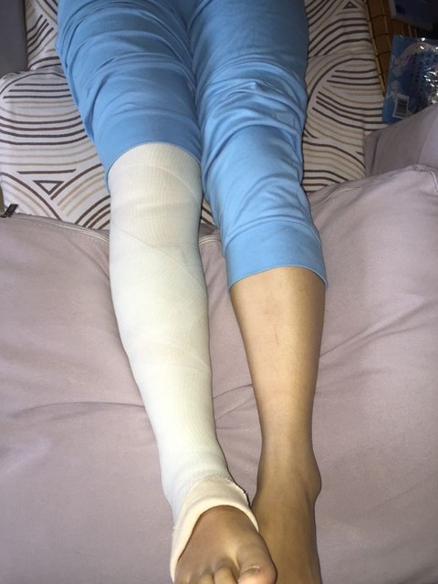 没有,我就把腿上打了个石膏.肚子没疼,我就知道我儿子很棒