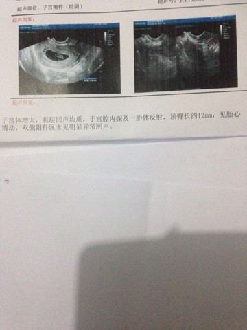 journal_insert_pic_215845821