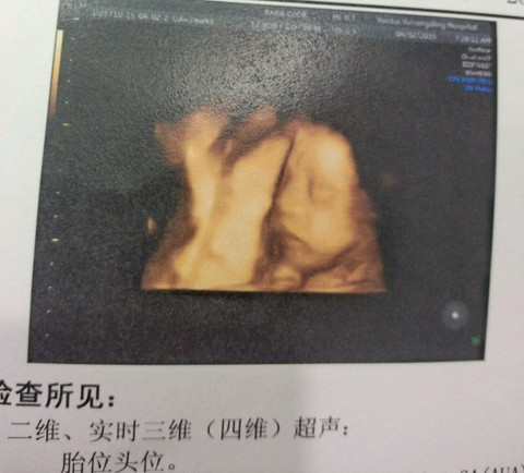 journal_insert_pic_215752573