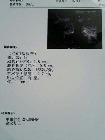 journal_insert_pic_216125379