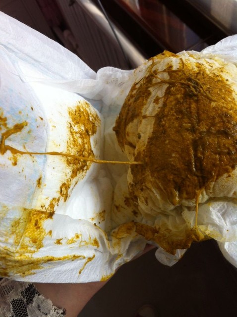 求问宝宝大便问题