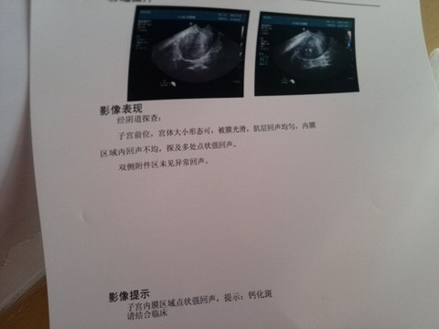 journal_insert_pic_218883937