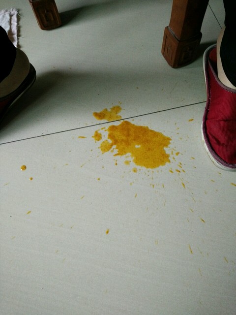 宝宝这样拉屎正常吗?