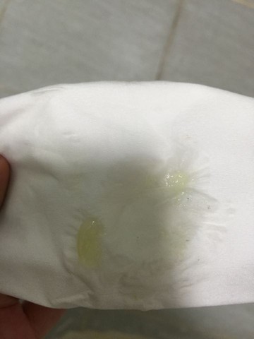刚才出现透明黄色果冻状分泌物 好担心