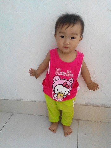 怎么我家的头发这么少,又不想给她剃光头,怎么办呢?