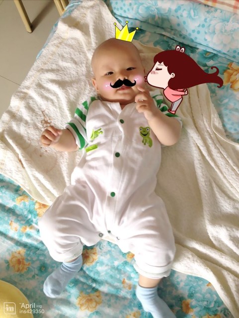 一样,小青蛙腿,我觉得挺可爱,长大了就会变直了