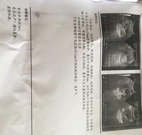 journal_insert_pic_234575879