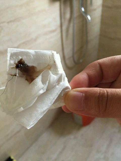 黑褐色分泌物,这是要生了吗