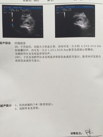 journal_insert_pic_235394976