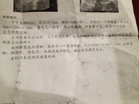 journal_insert_pic_237864485