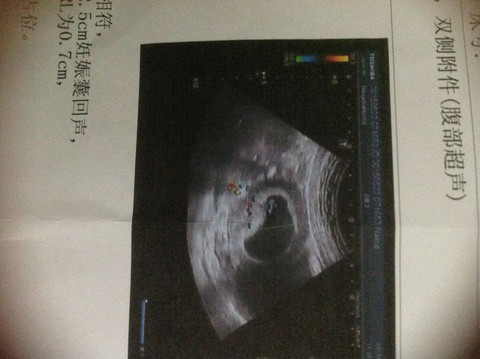 journal_insert_pic_238093780
