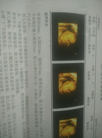 journal_insert_pic_244047238