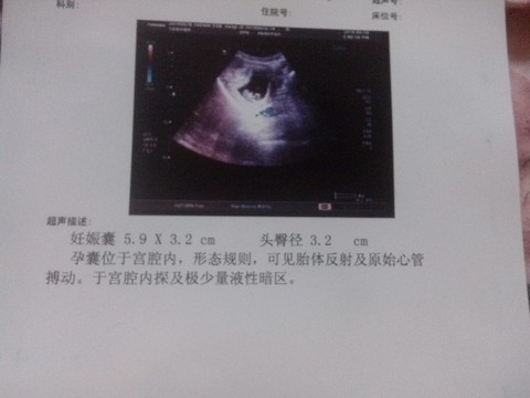 journal_insert_pic_245231715