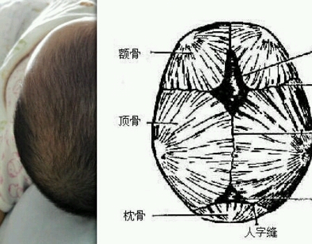 宝宝喜欢仰天睡,现在睡成扁头了,宝妈们有什么办法可以纠正呢?