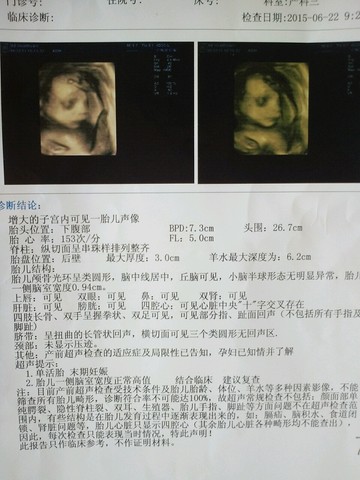 journal_insert_pic_247110347