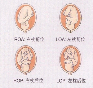 loa胎位图片示意图-千图网