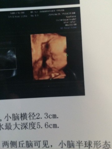 journal_insert_pic_250349888