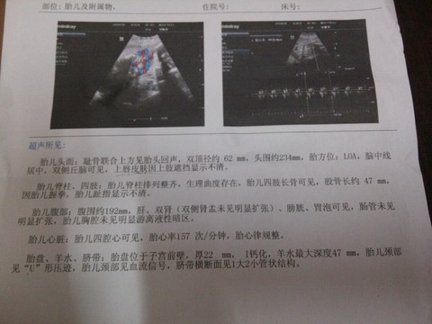 journal_insert_pic_252593136