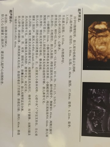 journal_insert_pic_253247441