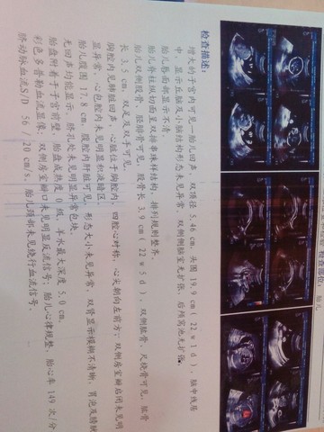 journal_insert_pic_259665573