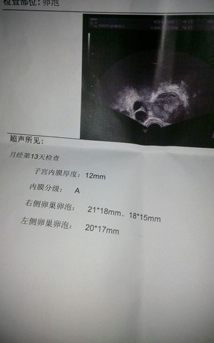 journal_insert_pic_264134418