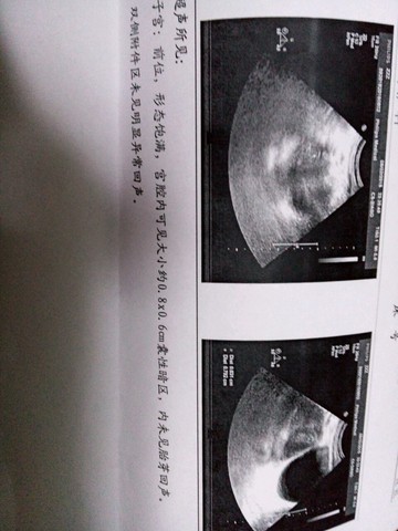 journal_insert_pic_264612720
